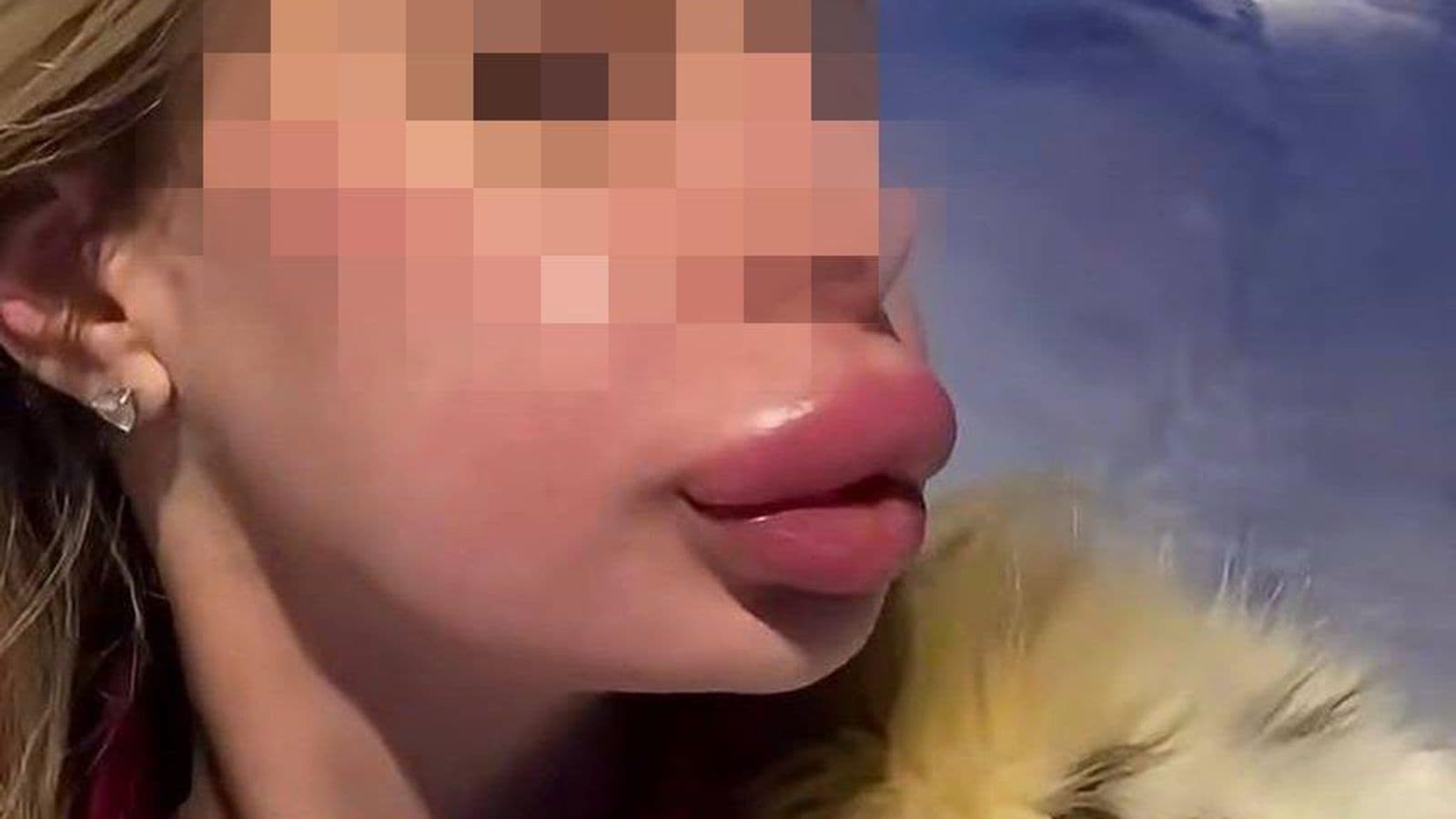 Губы