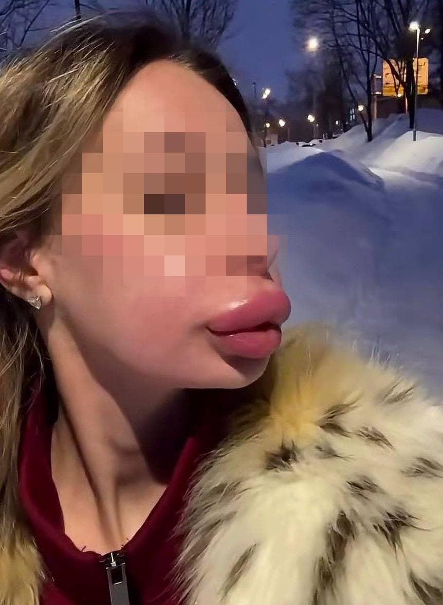 Губы