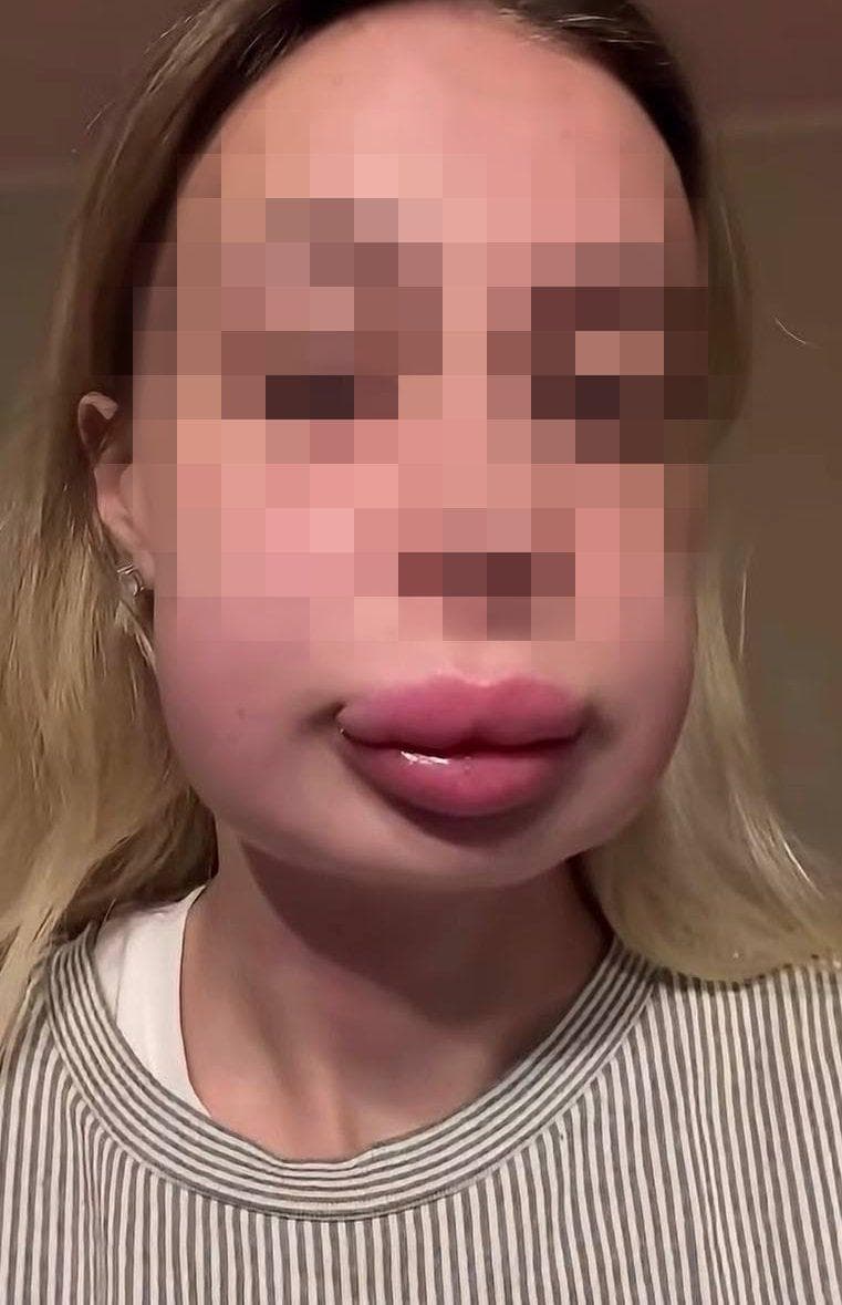 Губы